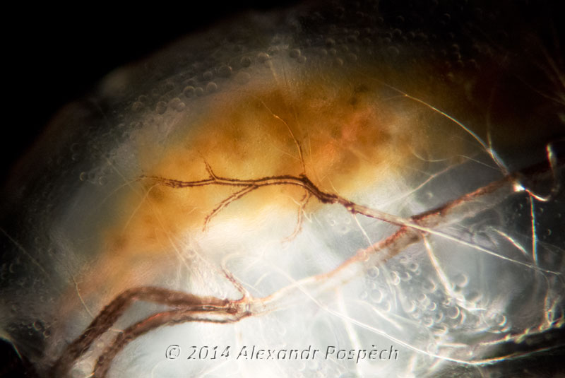 Trachea Darkfield